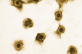 This transmission electron microscopic image depicts numbers of cytomegalovirus virions that were present in an unknown tissue sample. <i>Image credit: CDC/Sylvia Whitfield.</i> This transmission electron microscopic image depicts numbers of cytomegalovirus virions that were present in an unknown tissue sample. <i>Image credit: CDC/Sylvia Whitfield.</i>