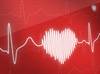 Improved Diagnosis of CVD in Patients With RA: Expert Insights Improved Diagnosis of CVD in Patients With RA: Expert Insights