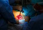 Some Hospitals May Be Overcharging for Hip and Knee Replacements Some Hospitals May Be Overcharging for Hip and Knee Replacements