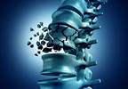 Predicting Vertebral Fracture Risk After Bisphosphonate Drug Holiday Predicting Vertebral Fracture Risk After Bisphosphonate Drug Holiday