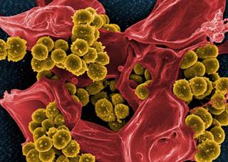 <i>Staphylococcus aureus</i> bacteria, enmeshed within the pseudopodia of a red-colored human white blood cell. <i>Image Credit: National Institute of Allergy and Infectious Diseases.</i> <i>Staphylococcus aureus</i> bacteria, enmeshed within the pseudopodia of a red-colored human white blood cell. <i>Image Credit: National Institute of Allergy and Infectious Diseases.</i>