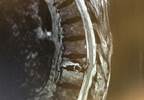 DXA Not Useful for Workup of Vertebral Compression Deformities With Normal BMD DXA Not Useful for Workup of Vertebral Compression Deformities With Normal BMD