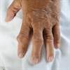 Incident Gout Risk, Serum Urate, and Comorbidities: What Are the Links? Incident Gout Risk, Serum Urate, and Comorbidities: What Are the Links?