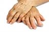 Is There a Link Between Asthma and Rheumatoid Arthritis? Is There a Link Between Asthma and Rheumatoid Arthritis?