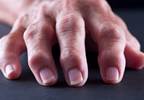 Osteoarthritis Chronic Hand Pain May Be Improved With Vibrating Gloves Osteoarthritis Chronic Hand Pain May Be Improved With Vibrating Gloves