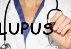 Kidney Transplantation Increases Survival in Lupus Nephritis Cases Kidney Transplantation Increases Survival in Lupus Nephritis Cases