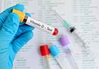Serum Vitamin D Levels Linked to Cardiorespiratory Fitness Serum Vitamin D Levels Linked to Cardiorespiratory Fitness