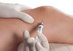 Septic Arthritis Outbreak Indicates Need for Improved Prevention in Outpatient Settings Septic Arthritis Outbreak Indicates Need for Improved Prevention in Outpatient Settings