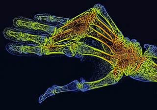 Tofacitinib is the first oral Janus kinase inhibitor for the treatment of rheumatoid arthritis. <i>Credit: ISM/SOVEREIGN</i> Tofacitinib is the first oral Janus kinase inhibitor for the treatment of rheumatoid arthritis. <i>Credit: ISM/SOVEREIGN</i>