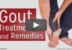 Gout Flares May Be Reduced With Febuxostat Gout Flares May Be Reduced With Febuxostat