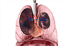 Assessment of Life Expectancy in Scleroderma-Associated Pulmonary Arterial Hypertension Assessment of Life Expectancy in Scleroderma-Associated Pulmonary Arterial Hypertension