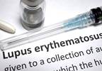Baricitinib Gets Fast Track Status for Systemic Lupus Erythematosus Baricitinib Gets Fast Track Status for Systemic Lupus Erythematosus