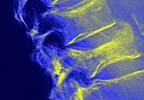 Osteoporotic Fracture Risk Predicted by Vertebral Trabecular Attenuation on Routine CT Osteoporotic Fracture Risk Predicted by Vertebral Trabecular Attenuation on Routine CT