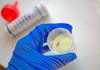 Predictors of Incident Proteinuria in Systemic Lupus Erythematosus Predictors of Incident Proteinuria in Systemic Lupus Erythematosus