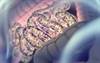 The Gut Microbiome and Rheumatoid Arthritis: Understanding the Connection The Gut Microbiome and Rheumatoid Arthritis: Understanding the Connection