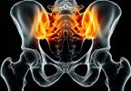 Sustained Reduction in axSpA Joint Inflammation With Certolizumab Pegol Sustained Reduction in axSpA Joint Inflammation With Certolizumab Pegol
