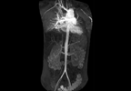 Large Vessel Vasculitis Imaging: Recommendations for Clinical Practice Large Vessel Vasculitis Imaging: Recommendations for Clinical Practice