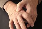 Hand Osteoarthritis Symptoms Not Reduced With Hydroxychloroquine Hand Osteoarthritis Symptoms Not Reduced With Hydroxychloroquine