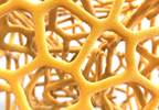 Abaloparatide Treatment Evaluated in Elderly Women With Osteoporosis Abaloparatide Treatment Evaluated in Elderly Women With Osteoporosis
