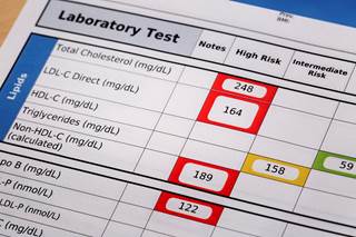 Baricitinib-induced lipid profile increases were not associated with increases in overall LDL-C:HDL-C ratios. Baricitinib-induced lipid profile increases were not associated with increases in overall LDL-C:HDL-C ratios.