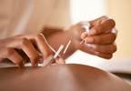 Fibromyalgia Pain, Fatigue May Be Improved With Acupuncture Fibromyalgia Pain, Fatigue May Be Improved With Acupuncture