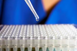 Despite low-level evidence, stem cell therapy for knee osteoarthritis is expanding. Despite low-level evidence, stem cell therapy for knee osteoarthritis is expanding.