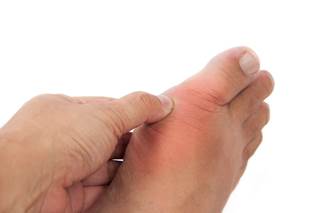 Febuxostat was noninferior to allopurinol in patients with gout and cardiovascular disease. Febuxostat was noninferior to allopurinol in patients with gout and cardiovascular disease.