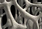 Bone Mineral Density Assessed in Young Adults With Prader-Willi Syndrome Bone Mineral Density Assessed in Young Adults With Prader-Willi Syndrome
