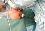 Bariatric Surgery Associated With Risk for Nonvertebral Fractures Bariatric Surgery Associated With Risk for Nonvertebral Fractures