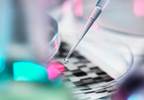 Gene Polymorphisms Predict Response to Tocilizumab, Rituximab in RA Gene Polymorphisms Predict Response to Tocilizumab, Rituximab in RA