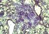 Expert Insight: A Closer Look at Neurological Manifestations of Sjogren Syndrome Expert Insight: A Closer Look at Neurological Manifestations of Sjogren Syndrome
