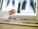 Predictors Identified for Myositis-Related Interstitial Lung Disease Mortality Predictors Identified for Myositis-Related Interstitial Lung Disease Mortality