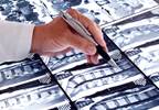 Identifying Early Structural Changes in Axial Spondyloarthritis: A Comparison of Scoring Methods Identifying Early Structural Changes in Axial Spondyloarthritis: A Comparison of Scoring Methods