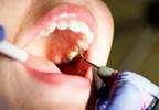 Oral Health Linked to Blood Pressure Profile, Treatment Success During Antihypertensive Therapy Oral Health Linked to Blood Pressure Profile, Treatment Success During Antihypertensive Therapy