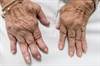 Inflammation: Is It the Link Between Rheumatoid Arthritis and Depression? Inflammation: Is It the Link Between Rheumatoid Arthritis and Depression?