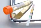 Do Value-Based Incentive Programs Reduce UTI Rates in Intensive Care Settings? Do Value-Based Incentive Programs Reduce UTI Rates in Intensive Care Settings?