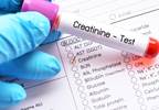 Prevalence, Risk Factors of Renal Impairment Evaluated in Spondyloarthritis Prevalence, Risk Factors of Renal Impairment Evaluated in Spondyloarthritis