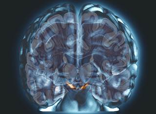 Impairments in attention, recall, concentration, information processing speed, spatial processing, and word-finding are frequent occurrences in patients with SLE. <i>Credit: ISM / SOVEREIGN</i> Impairments in attention, recall, concentration, information processing speed, spatial processing, and word-finding are frequent occurrences in patients with SLE. <i>Credit: ISM / SOVEREIGN</i>