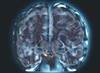 Managing Cognitive Dysfunction in Systemic Lupus Erythematosus Managing Cognitive Dysfunction in Systemic Lupus Erythematosus