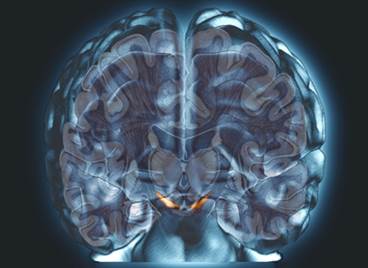 Managing Cognitive Dysfunction in Systemic Lupus Erythematosus Managing Cognitive Dysfunction in Systemic Lupus Erythematosus