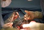 Renal Transplantation Linked to Improved Survival for ESRD Due to Granulomatosis With Polyangiitis Renal Transplantation Linked to Improved Survival for ESRD Due to Granulomatosis With Polyangiitis
