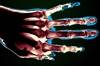 RA Associated With Greater Reduction in Short-Term Disease Burden vs Osteoarthritis RA Associated With Greater Reduction in Short-Term Disease Burden vs Osteoarthritis