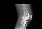 Comprehensive Care for Joint Replacement Model Cuts Costs Comprehensive Care for Joint Replacement Model Cuts Costs