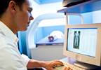 Etelcalcetide Found to Increase Bone Mineral Density in SHPT Etelcalcetide Found to Increase Bone Mineral Density in SHPT