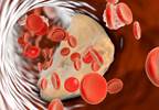 Walking Disability Associated With Arterial Stiffness in Osteoarthritis Walking Disability Associated With Arterial Stiffness in Osteoarthritis