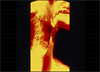 Swallowing Disorders in RA: Epidemiology and Patient Management Swallowing Disorders in RA: Epidemiology and Patient Management