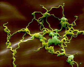 There is a general lack of understanding of Lyme disease among physicians, and Lyme neuroborreliosis is notoriously very difficult to recognize in children. <i>Credit:Eye of Science/Science Source</i>