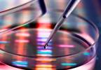 Genetic Screening May Predict Osteoporosis, Fracture Risk Genetic Screening May Predict Osteoporosis, Fracture Risk