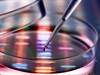 Genetic Screening May Predict Osteoporosis, Fracture Risk Genetic Screening May Predict Osteoporosis, Fracture Risk
