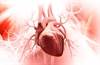 SYNTAX Score: A Predictive Scale for Adverse CV Events in Patients With Diabetes, CAD Undergoing PCI SYNTAX Score: A Predictive Scale for Adverse CV Events in Patients With Diabetes, CAD Undergoing PCI
